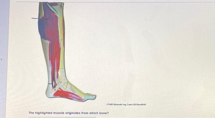 The highlighted muscle originates from which bone