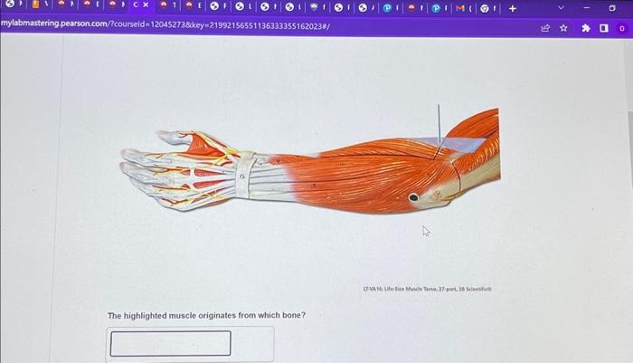 Muscle highlighted lt solved which